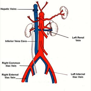 Treatment Varicose Veins - Finally Getting Rid Of Spider Veins