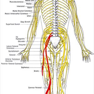 Telangiectasia Spider Veins - What Are Varicose Veins